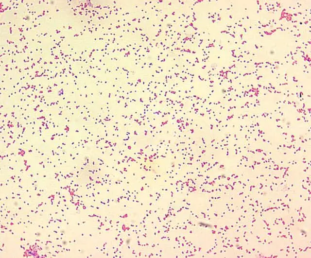A microscopic image of Brucella spp - a gram-negative of the staining morphology