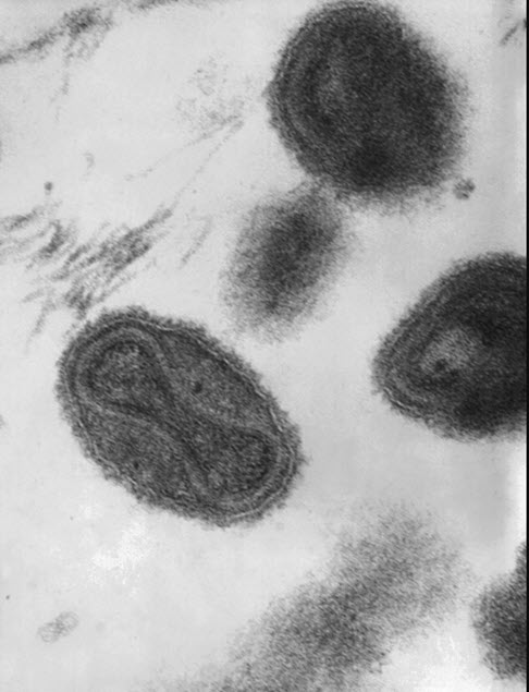 A microscopic image of Variola virus
